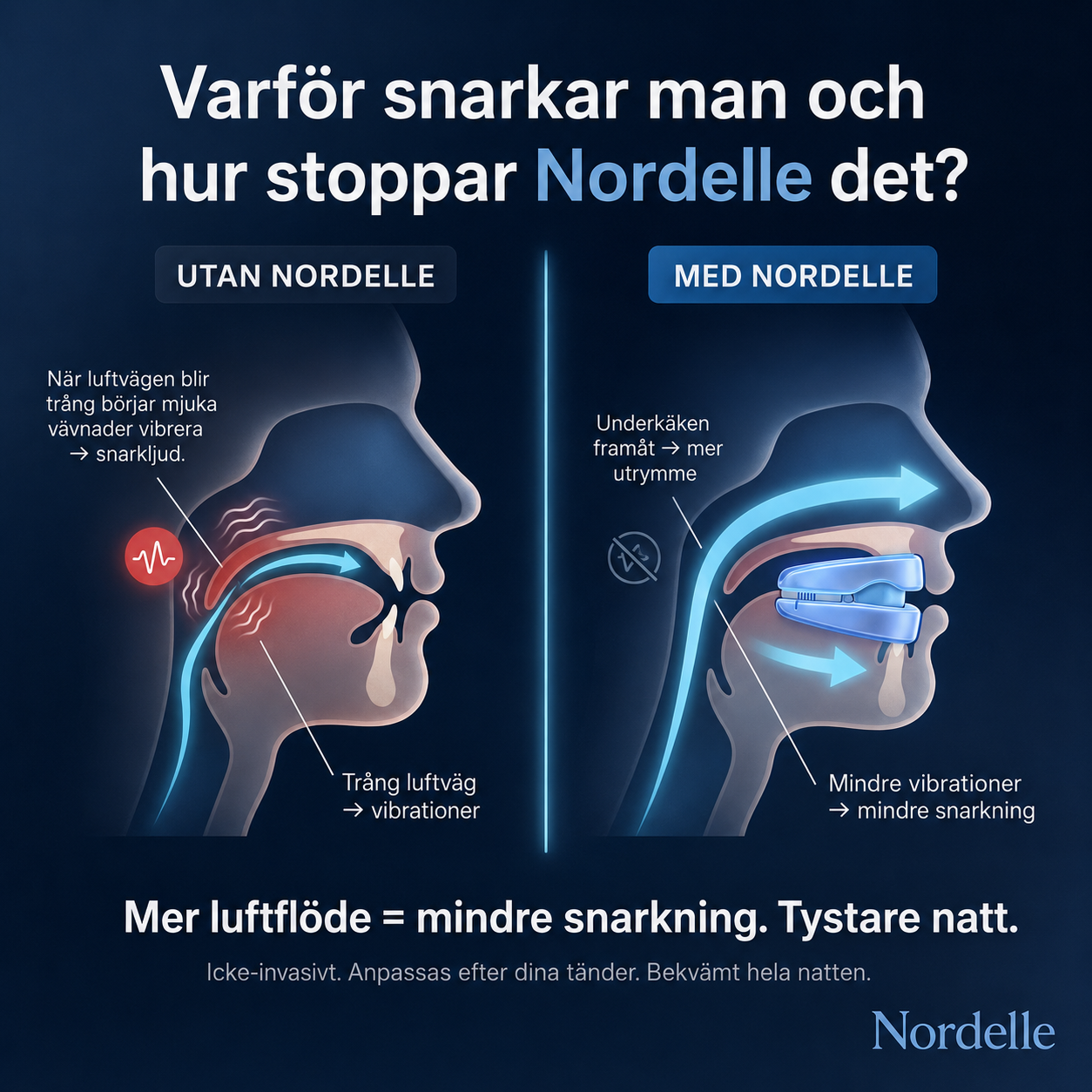 Nordelle™ – Reduces Snoring Naturally
