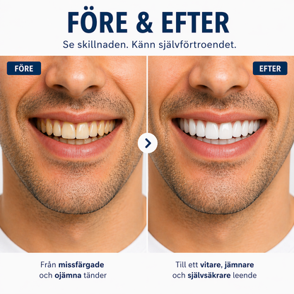 Nordelle® Cosmetic Dentures