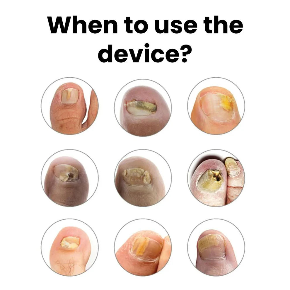 The Orthovital Device